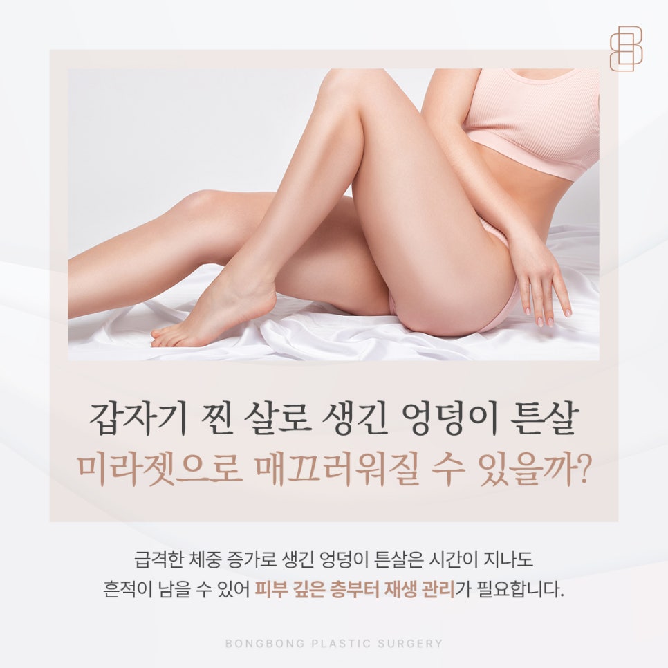 갑자기 찐 살로 생긴 엉덩이 튼살 미라젯으로 매끄러워질 수 있을까? 관련 이미지 1