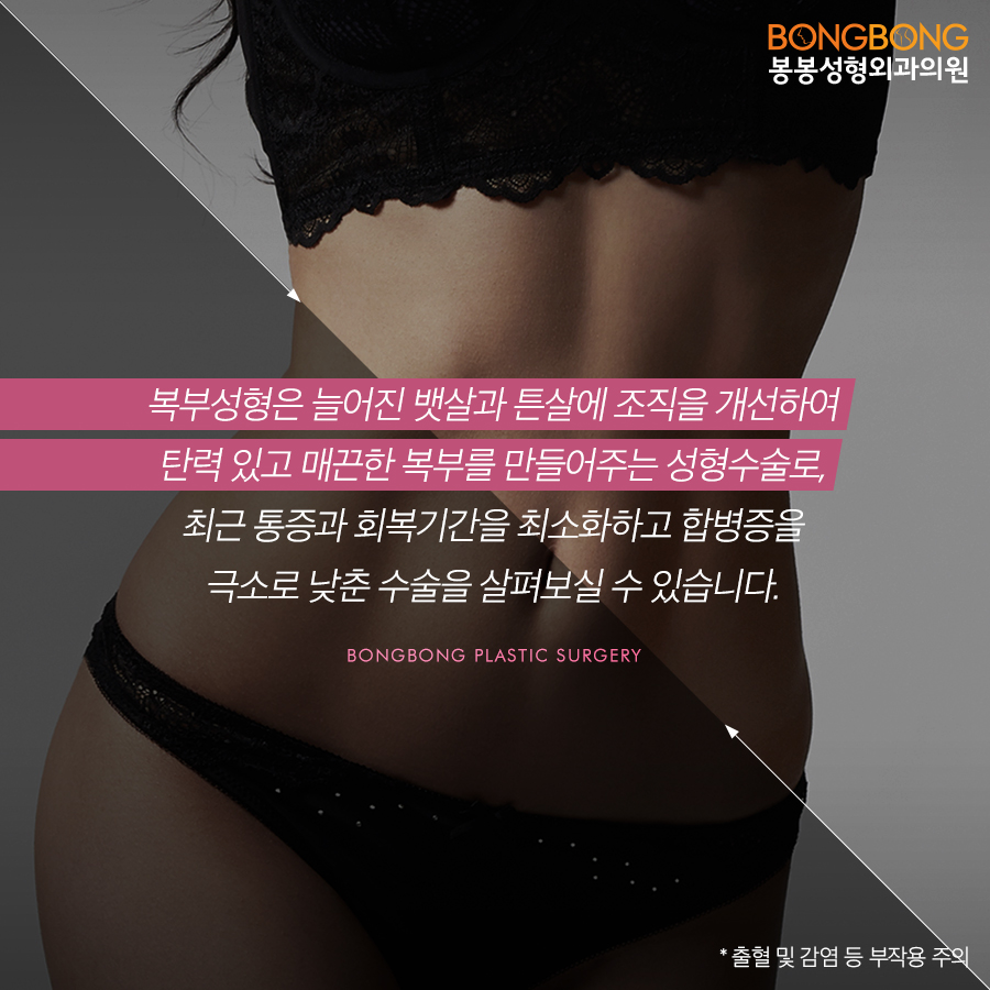 복부성형수술, 트고 늘어진뱃살 개선에 탁월해 관련 이미지 3