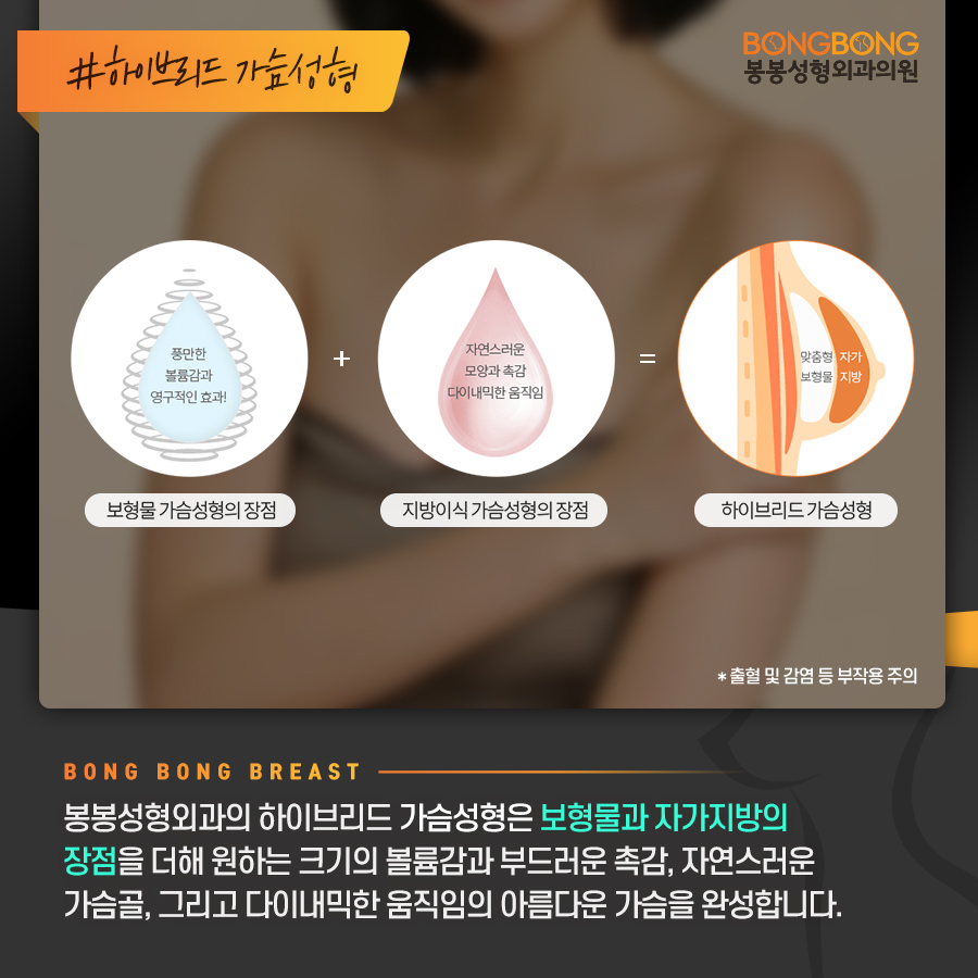 나에게 가장 어울리는 가슴성형을 위한 체크 포인트는? 관련 이미지 7