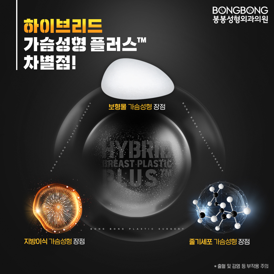 봉봉성형외과의 하이브리드가슴성형플러스TM는 뭐지? 관련 이미지 4