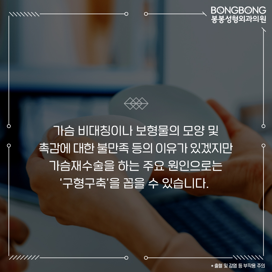 가슴재수술 더 이상 실패 안하려면 이것만 명심하세요 관련 이미지 5