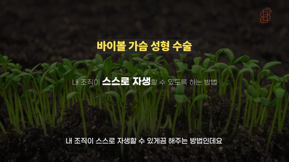 티 안나는 자연스러운 가슴성형 원한다면 바이볼 고려! 관련 이미지 5