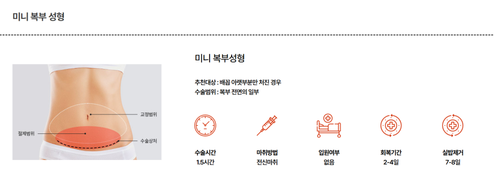 뱃살만 안빠져요 개선책은 복부성형수술 관련 이미지 4