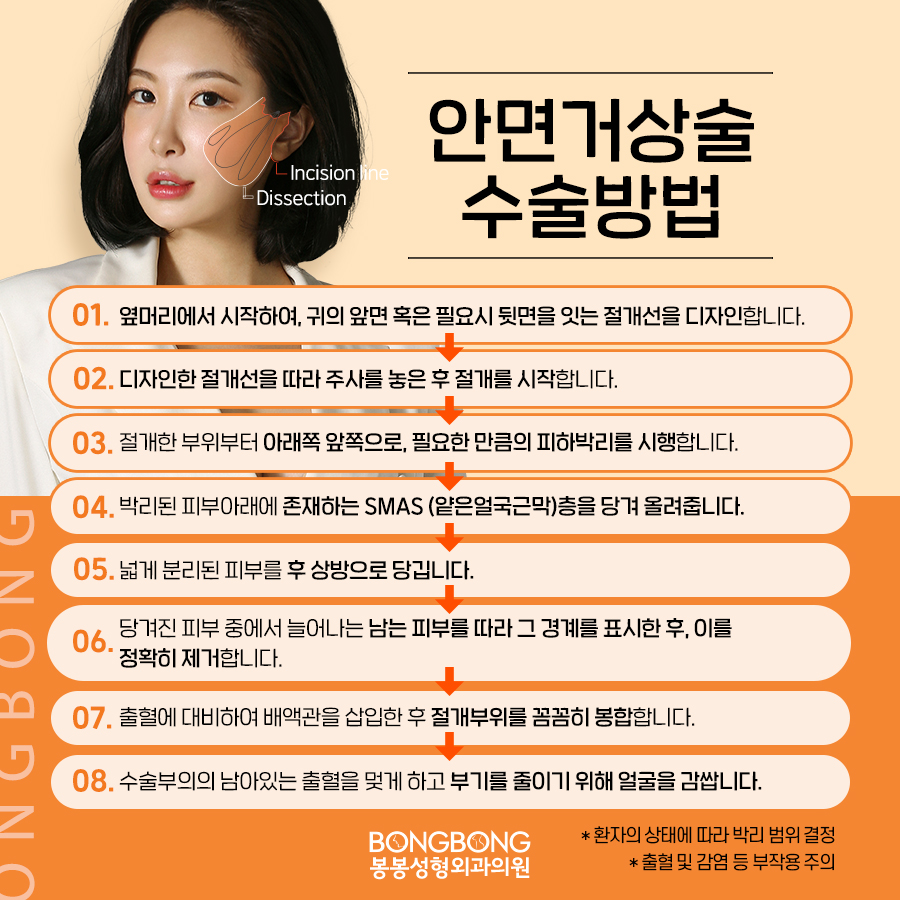 안면거상술잘하는곳 안면거상술 후기 솔깃! 관련 이미지 7