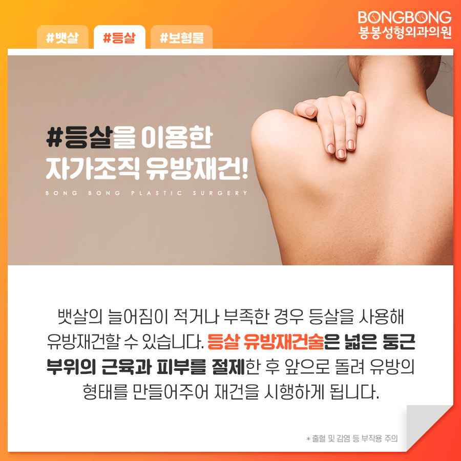 유방재건술방법 어떤 것이 있는지 봉봉성형외과에서 알려드림 관련 이미지 6