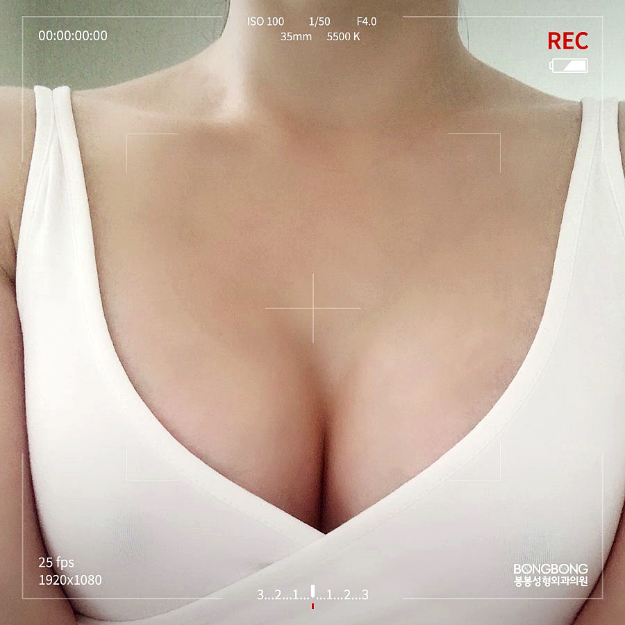 임산부 함몰유두 개선 방법은? 편하게 모유수유 하기 관련 이미지 3