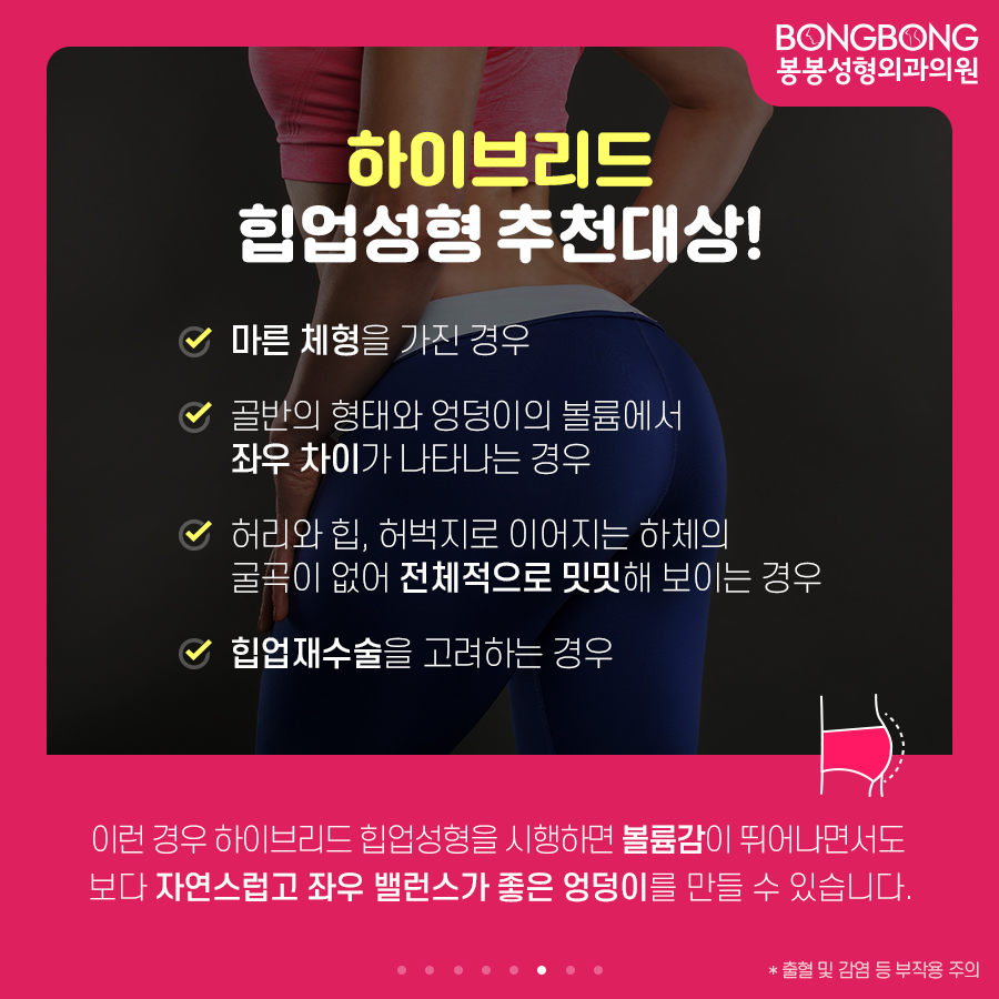 하이브리드 힙업성형방법, 세계최초 개발한 봉봉성형외과 관련 이미지 6