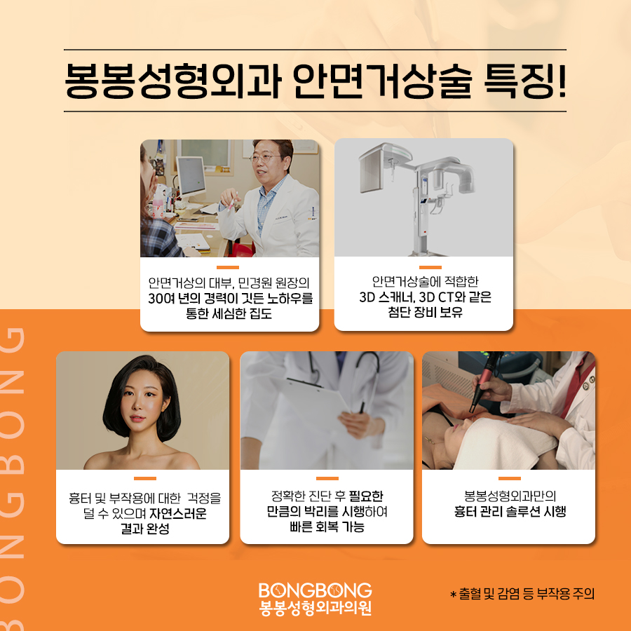 안면거상술잘하는곳 안면거상술 후기 솔깃! 관련 이미지 6