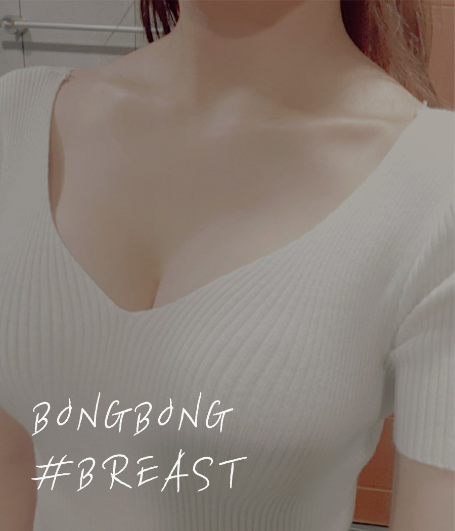 모티바보형물가슴성형후기 좋은 이유는? 관련 이미지 2