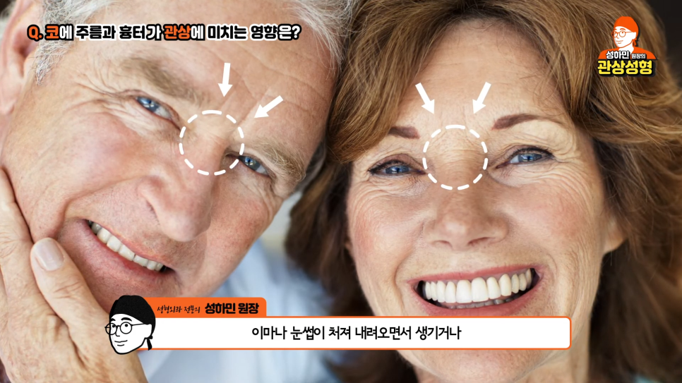 [봉봉성형외과] 높은콧대 관상에도 좋을까? 관련 이미지 6