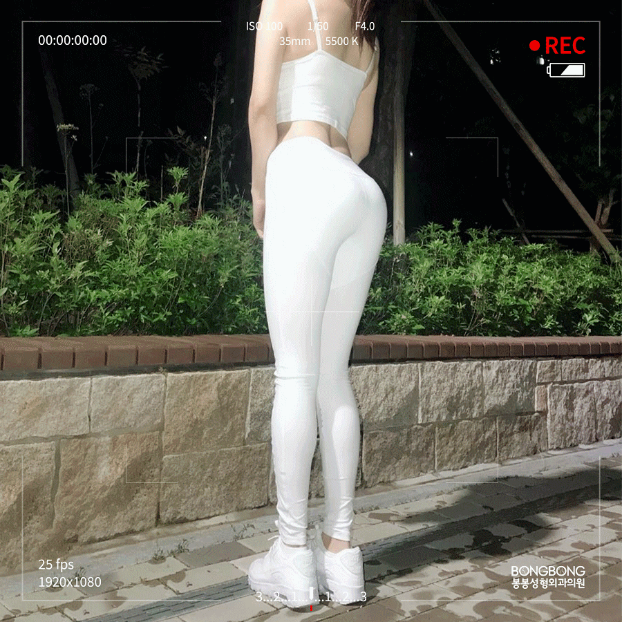 처진엉덩이성형 자연스러운 애플힙 모양으로 관련 이미지 3