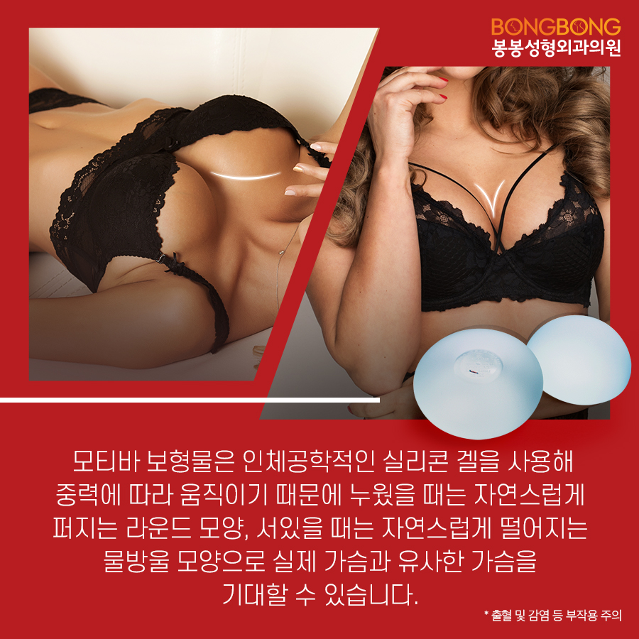 안전한 가슴보형물, 모티바 - 봉봉성형외과에서 알아보자 관련 이미지 4