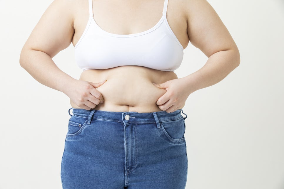 살쪄서 튼살 생김, 미라젯 시술이면 돌아갈 수 있을까? 관련 이미지 3