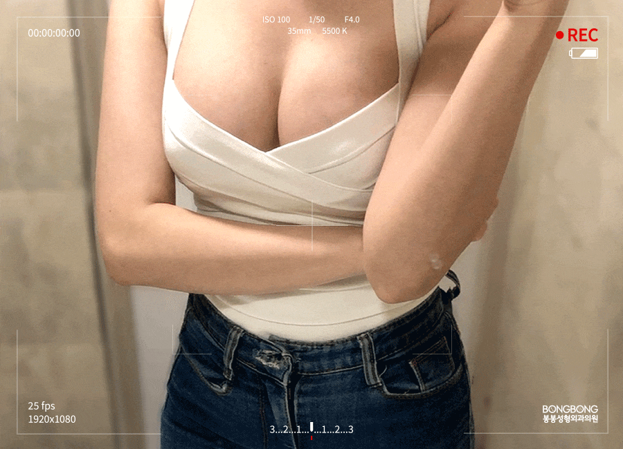 가슴확대수술 가슴성형종류 보형물 선택부터 비교분석! 관련 이미지 3