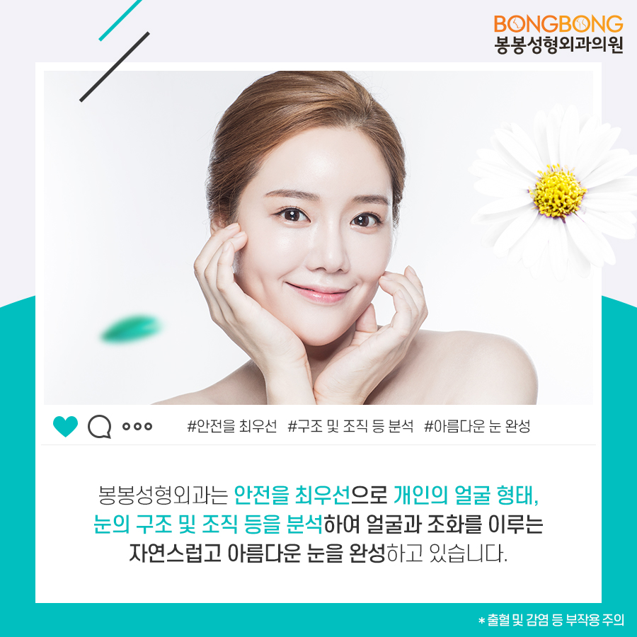 눈성형종류 중 내게 맞는 것 봉봉성형외과 관련 이미지 6