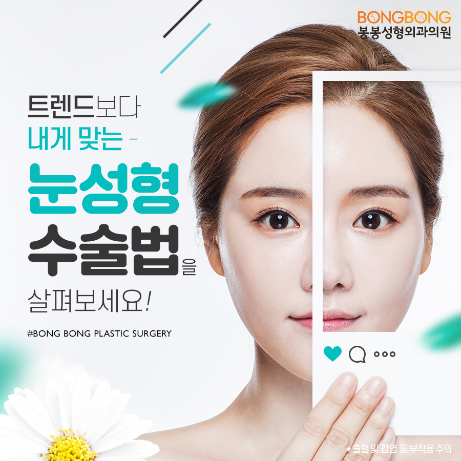 눈성형종류 중 내게 맞는 것 봉봉성형외과 관련 이미지 1