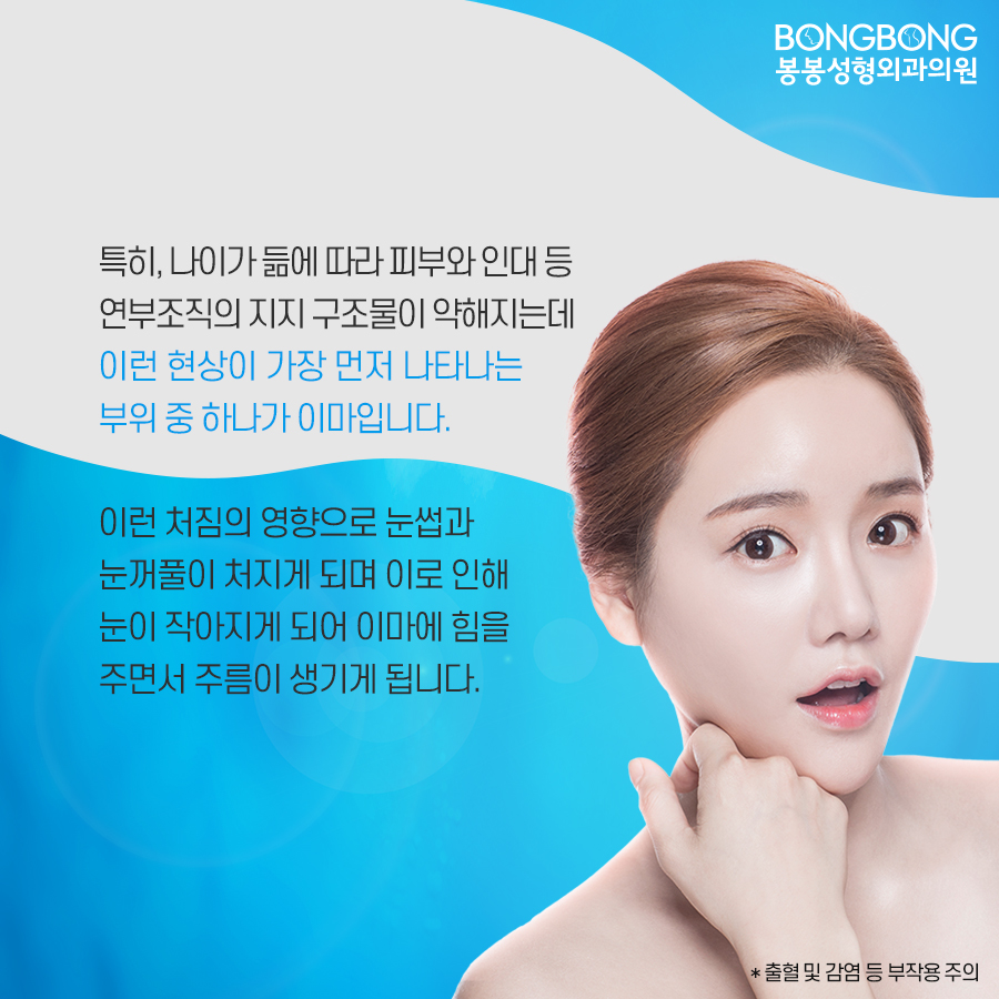 내시경이마거상술 효과는? 관련 이미지 4