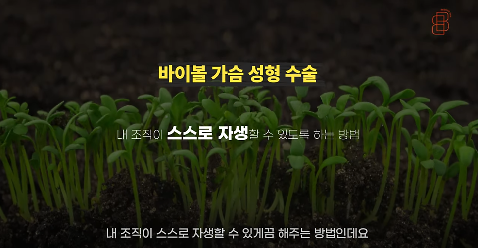 바이볼 가슴성형, 생체 친화적인 보형물이 필요 없는 4세대 확대수술! 관련 이미지 7