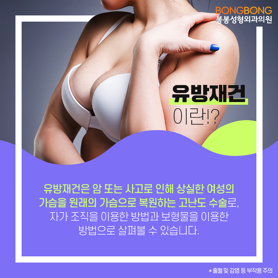 유방재건술 방법은 어떤 것이 있나요? 관련 이미지 4