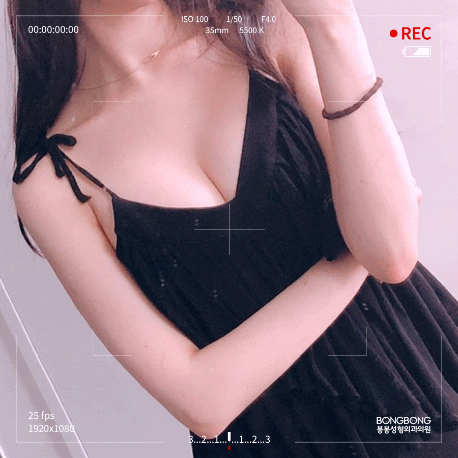 가슴 작음 고민, 크기 키워주는 가슴확대수술 방법은? 관련 이미지 4
