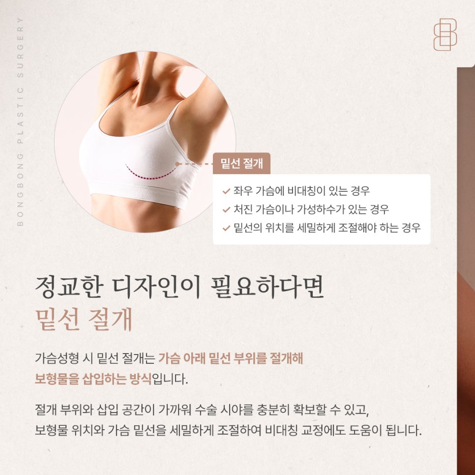 회복 빠른 밑선 vs 흉터 감추는 겨드랑이, 나에게 맞는 가슴성형 절개방법은? 관련 이미지 2