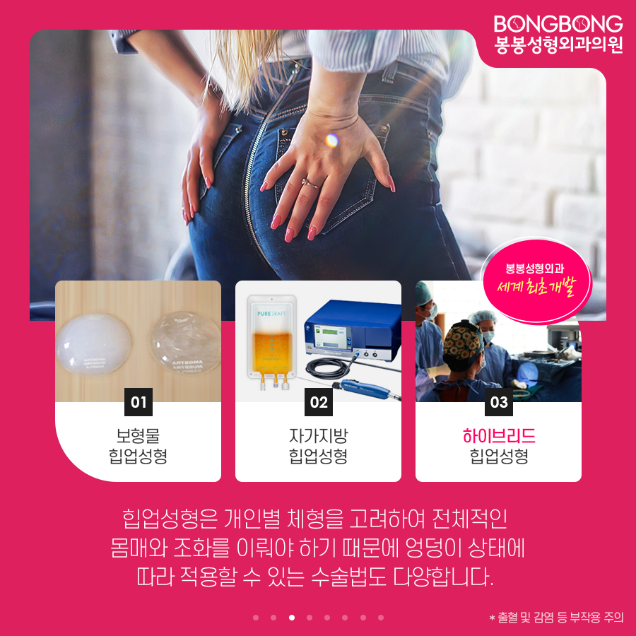 하이브리드 힙업성형방법, 세계최초 개발한 봉봉성형외과 관련 이미지 3