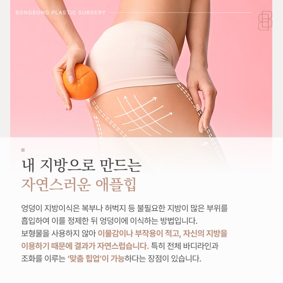 지방흡입 후 힙업, 동시에 가능할까? 관련 이미지 3