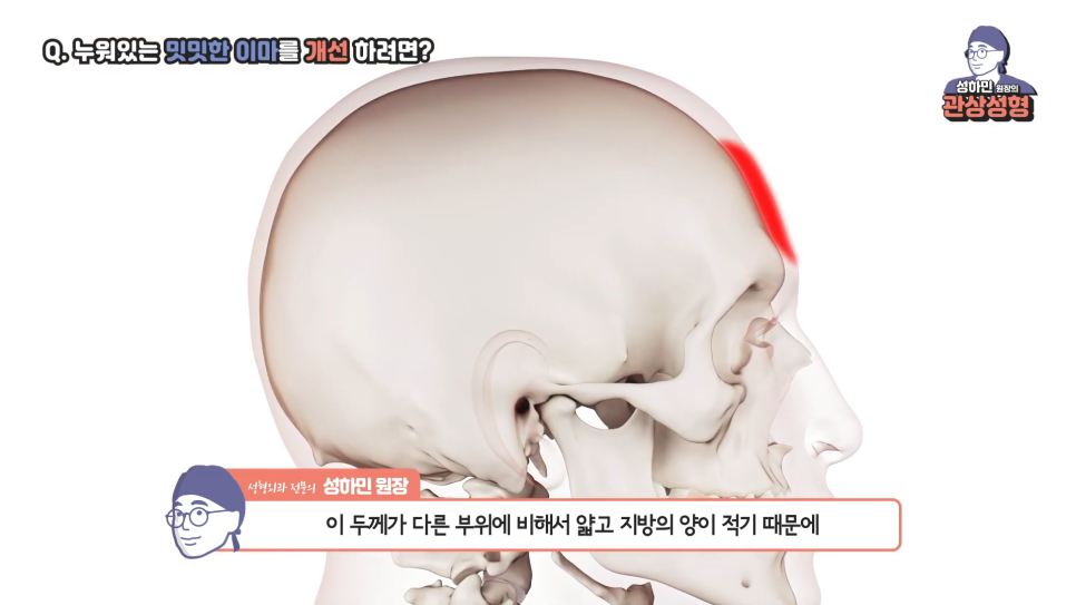 [봉봉성형외과] 넓은 이마, 납작한 이마, 좁은 이마 교정법 한 눈에! 관련 이미지 3