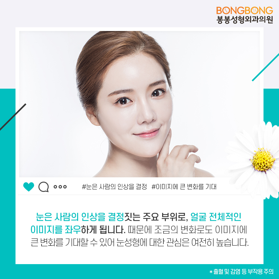 눈성형종류 중 내게 맞는 것 봉봉성형외과 관련 이미지 2