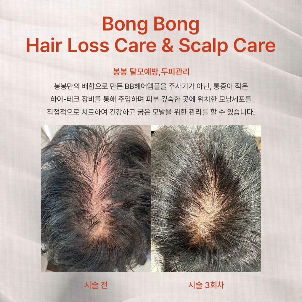 머리카락 얇아짐, 만지는 습관 때문! 해결 방법은?! 관련 이미지 3