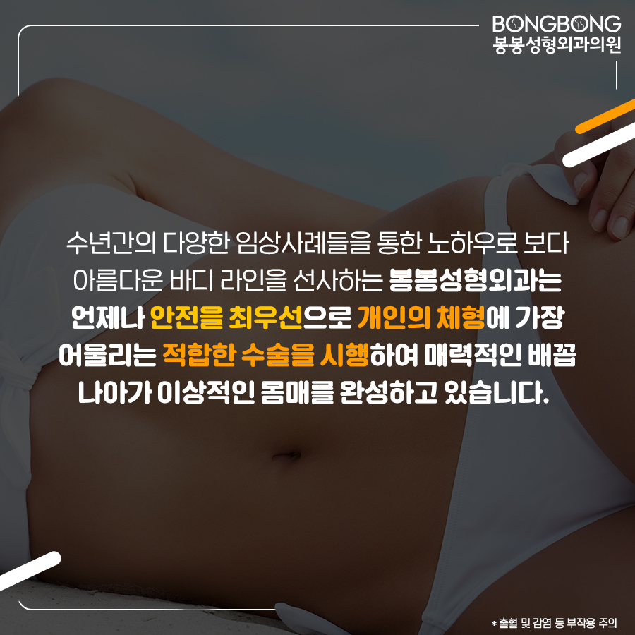 참외배꼽 콤플렉스라면 봉봉성형외과의 배꼽성형 관련 이미지 7