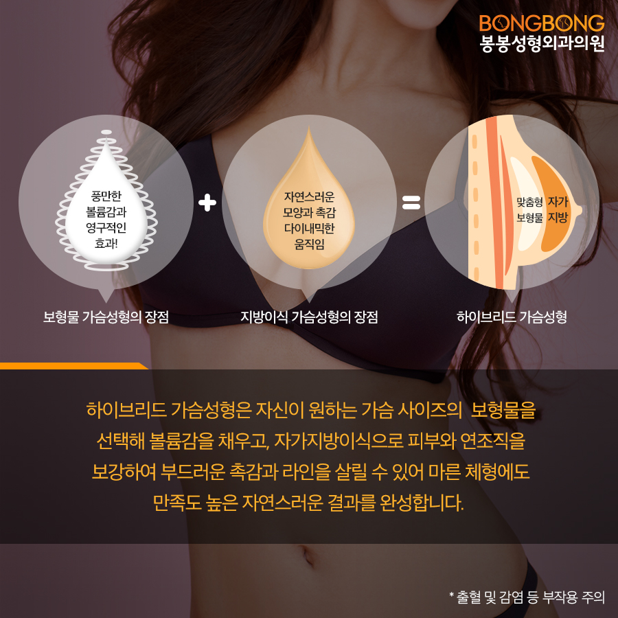 가슴 보형물 + 가슴골 지방이식 하이브리드가슴성형 원조 어디? 관련 이미지 3