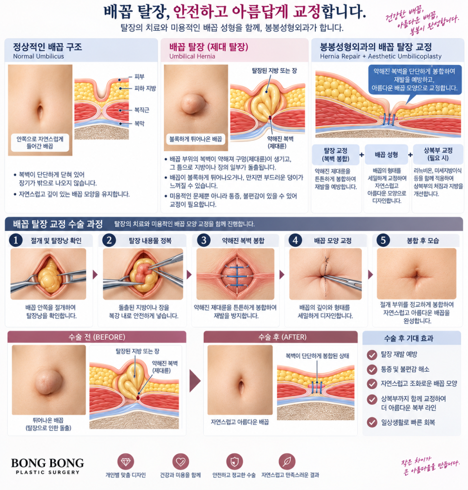 참외배꼽 그냥 둬도 될까 탈장과 구분하는 기준 관련 이미지 2