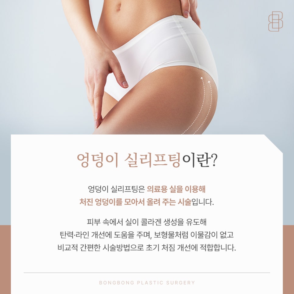 엉덩이 실리프팅 탄력 잃은 힙라인을 살릴 수 있을까 관련 이미지 3