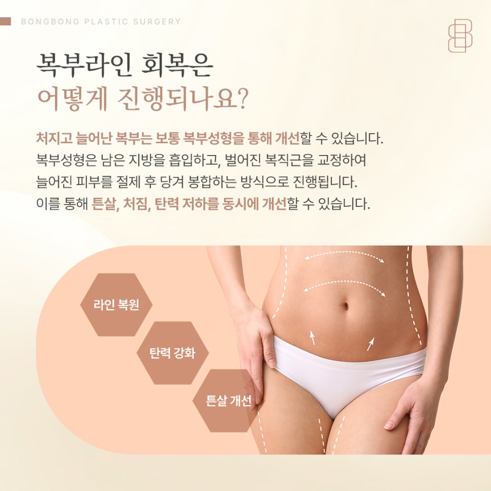 출산 후 늘어진 복부, 라인과 탄력은 어떻게 회복할 수 있을까? 관련 이미지 6