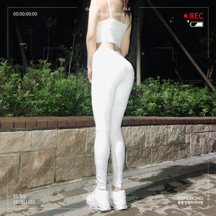 여자 힙업성형 탄력있고 볼륨감 있는 엉덩이를 위한 관련 이미지 5