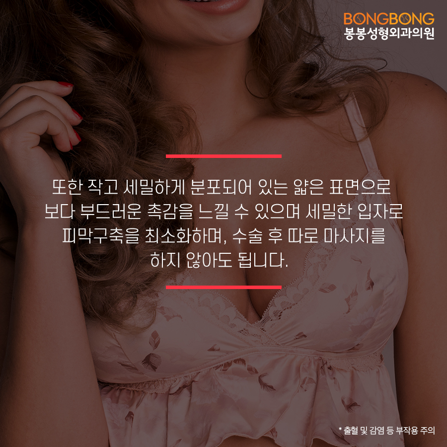 안전한 가슴보형물, 모티바 - 봉봉성형외과에서 알아보자 관련 이미지 5