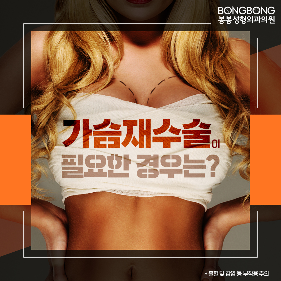 가슴보형물제거, 안전과 만족을 따진다면? 관련 이미지 2