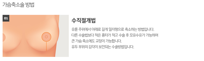 가슴축소술후기, 가슴성형수술잘하는곳 봉봉성형외과에서 확인~ 관련 이미지 3