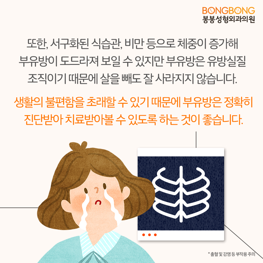 겨드랑이 부유방제거 오래 고민하고 있었다면 봉봉성형외과에서! 관련 이미지 3
