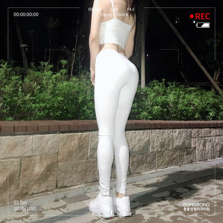 이상적인 볼륨감 및 모양의 골반라인을 위한 엉덩이성형! 관련 이미지 2