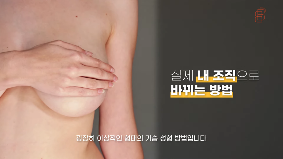 티 안나는 자연스러운 가슴성형 원한다면 바이볼 고려! 관련 이미지 4