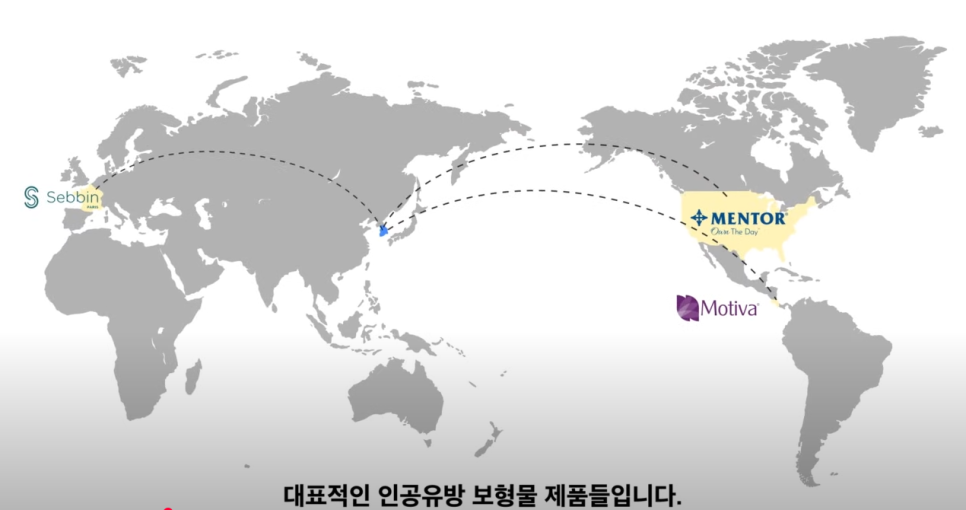 가슴보형물종류 모티바, 멘토, 세빈 차이 알아보기 관련 이미지 15