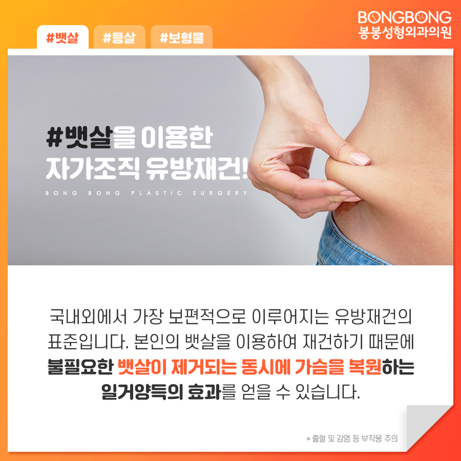 유방재건술방법 어떤 것이 있는지 봉봉성형외과에서 알려드림 관련 이미지 5
