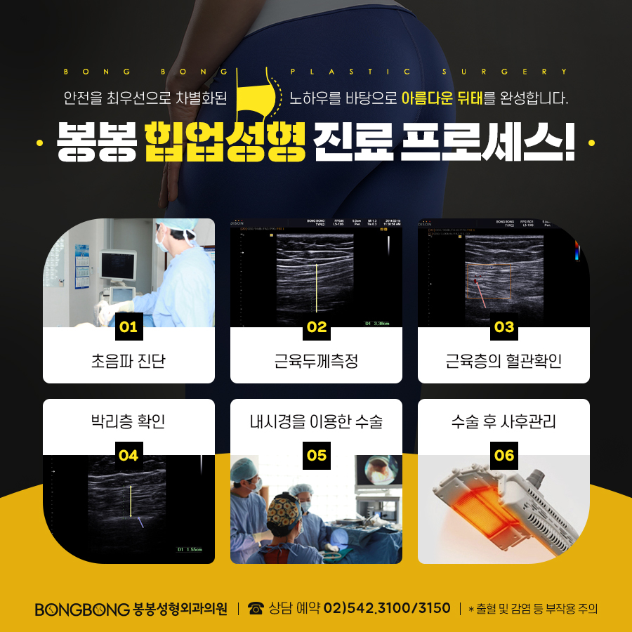 힙업지방이식 언제까지 부러워만할꺼야 관련 이미지 5