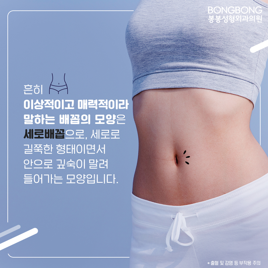참외배꼽 콤플렉스라면 봉봉성형외과의 배꼽성형 관련 이미지 4
