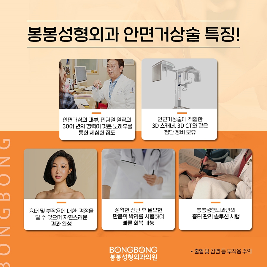 팔자주름없애기 효과적 방법은 안면거상술! 관련 이미지 2