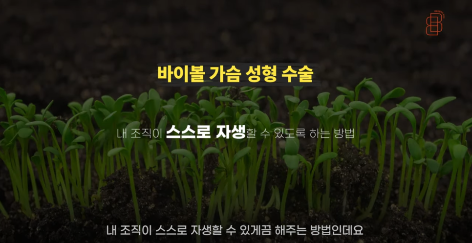 [봉봉성형외과] 생체적합성이 높은 재료를 이용한 관련 이미지 11