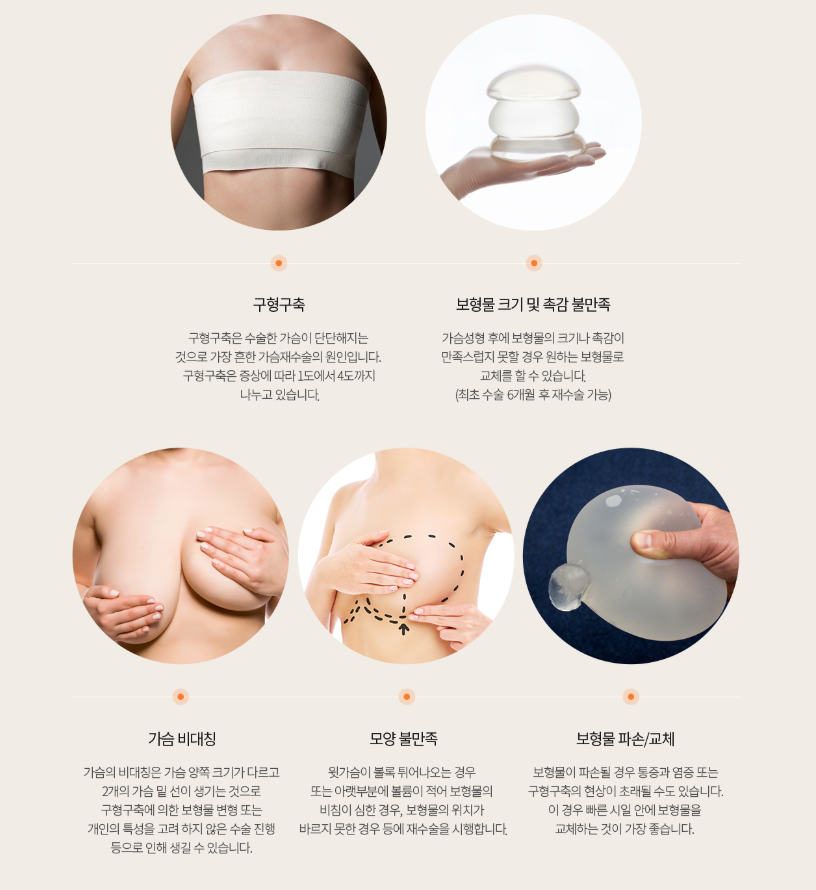 더이상의 실패는 없도록, 아름답고 안전한 가슴재수술 체크 사항은? 관련 이미지 11