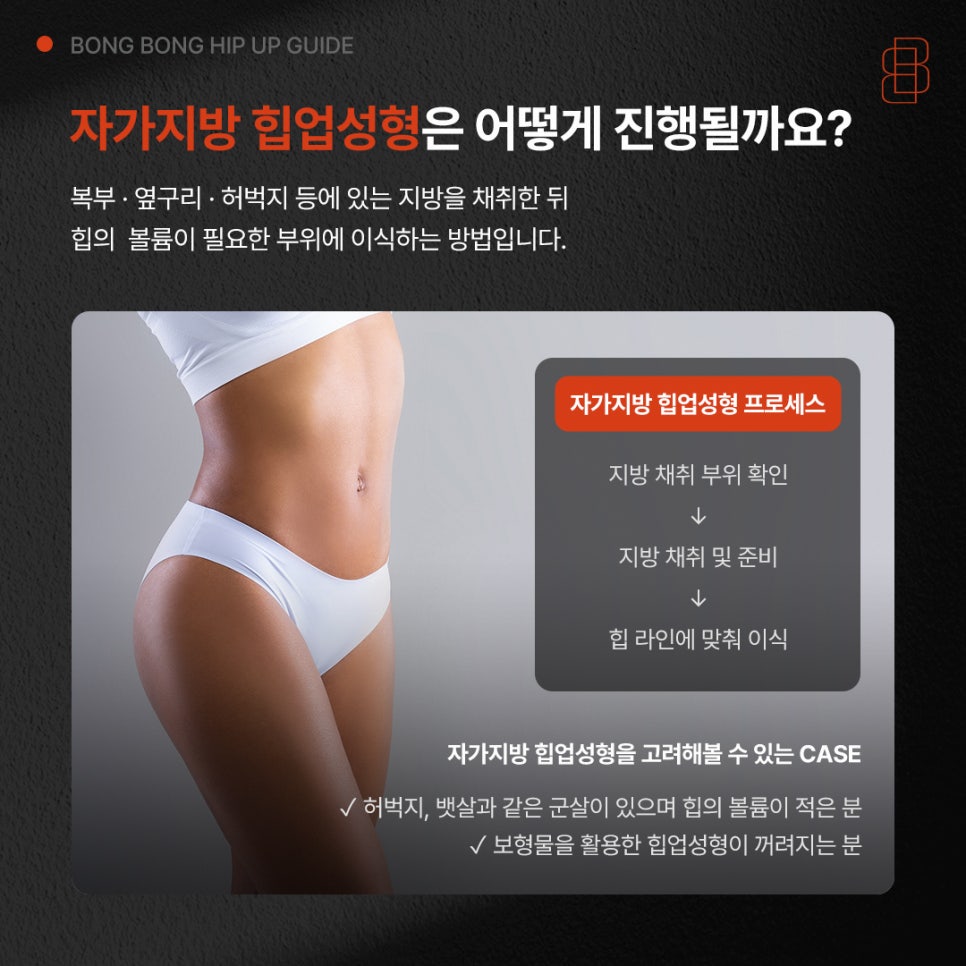 Hip Augmentation Surgery for an Attractive Hip Shape Suited to Your Body Type image 7